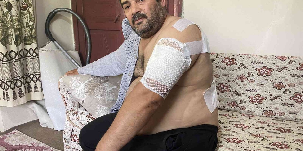 Ayı Saldırısına Uğrayan Vatandaş: “beni Öldü Zannetti”