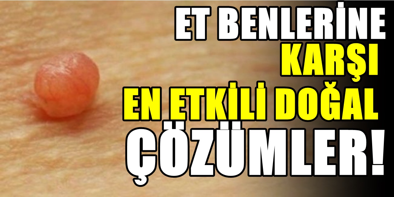 Et benlerinden kurtulmak için en kolay yöntem, ilginç bir şekilde etki ediyor