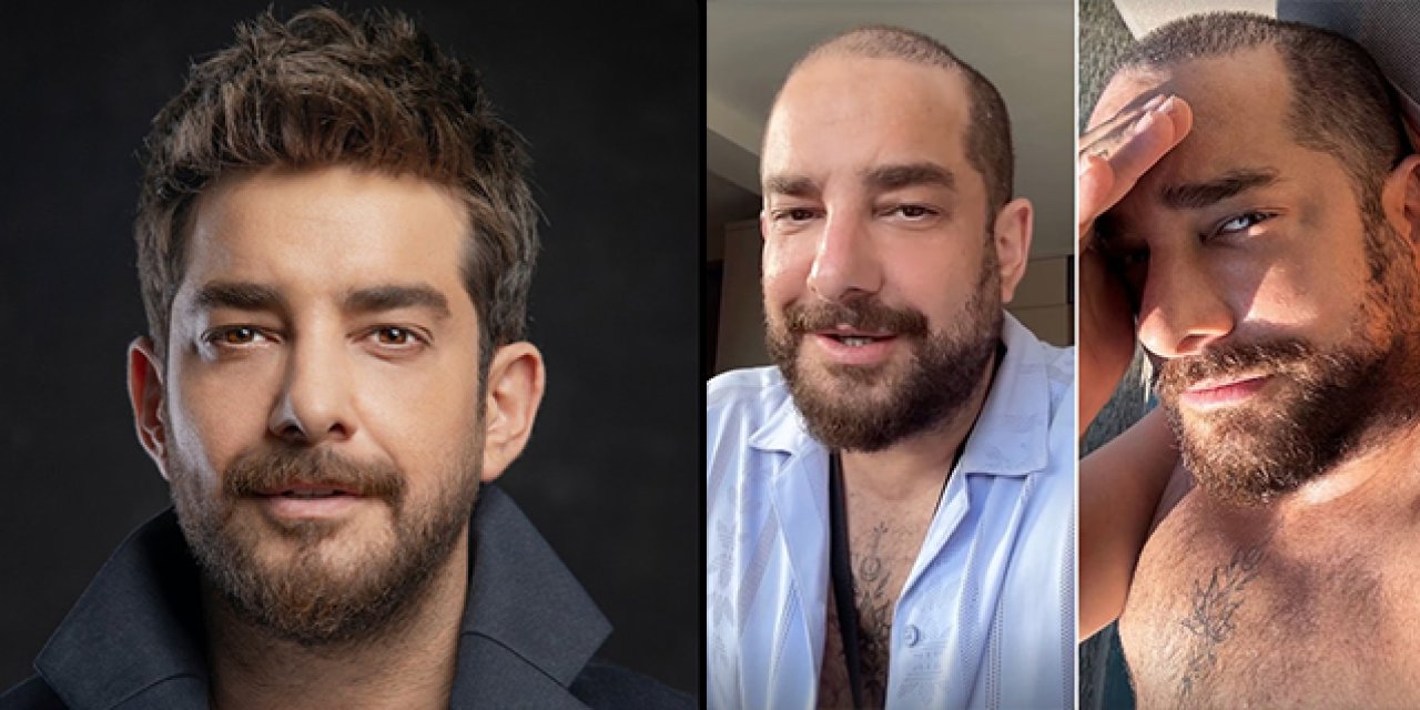 Enis Arıkan'ın saçsız hali ortaya çıktı