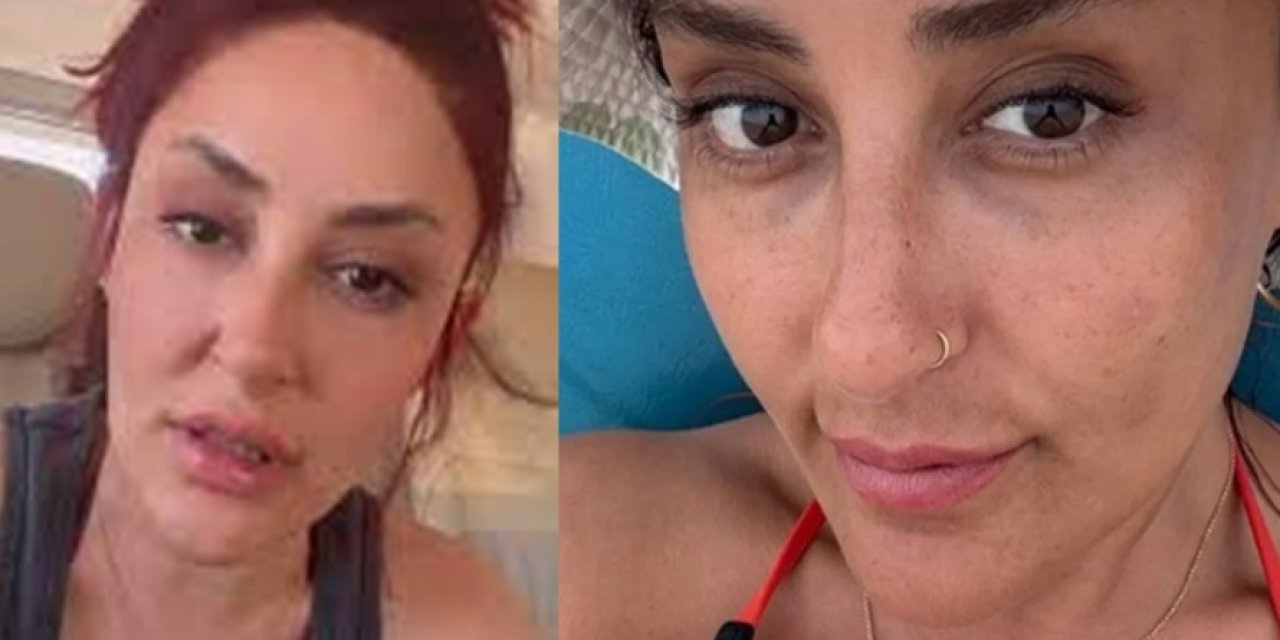 Şarkıcı Melek Mosso'dan korkutan haber! Kaza geçirdi