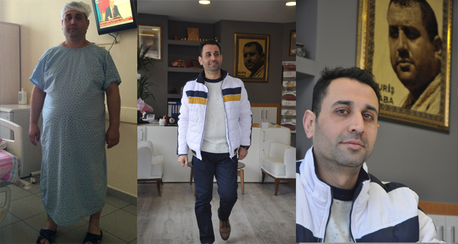 9 ayda 57 kilo verdi