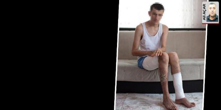 Her gün dövüldü sıcak suyla haşlandı