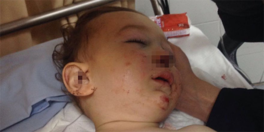 16 aylık bebek 3. kattan düştü