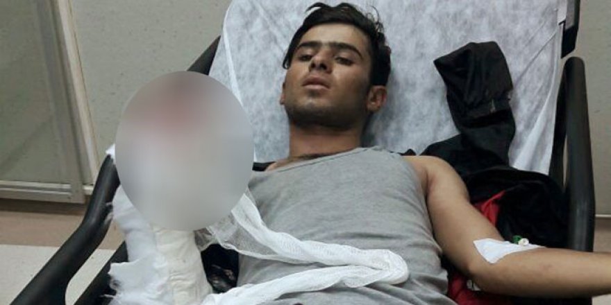 İstanbul'da karakola atacağı bomba elinde patladı