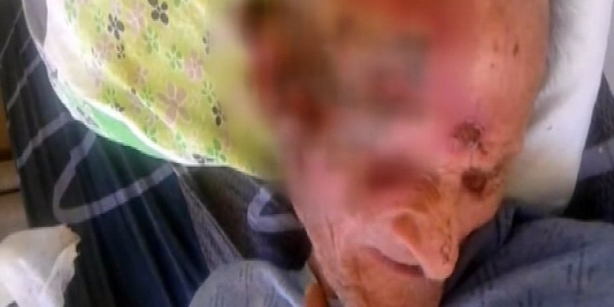 Antalya'da bir huzurevinde gündeme gelen yaşlı adam öldü