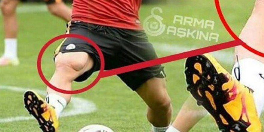 Lukas Podolski’nin bacak kası şaşırttı