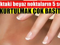 Tırnaktaki beyaz noktaların 5 sebebi