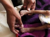 WHO: 'Yemen Halkının Yüzde 80'i Yardıma Muhtaç'