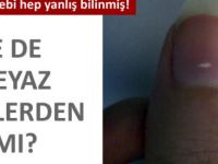 Tırnaklarınızdaki hastalık belirtilerine dikkat edin