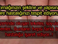 Tırnaklarınız hastalığınızı söylüyor! Dikkat etmekte fayda var