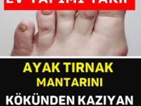 Ayak mantarı ! İşte Kurtaran o yöntem