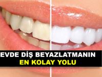 Sararmış Dişlerinizi bu tarifle 10 dakika içerisinde bembeyaz yapabilirsiniz