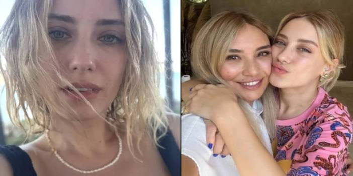 Hazal Kaya’nın Yüzündeki Büyük Değişim Olay Oldu!