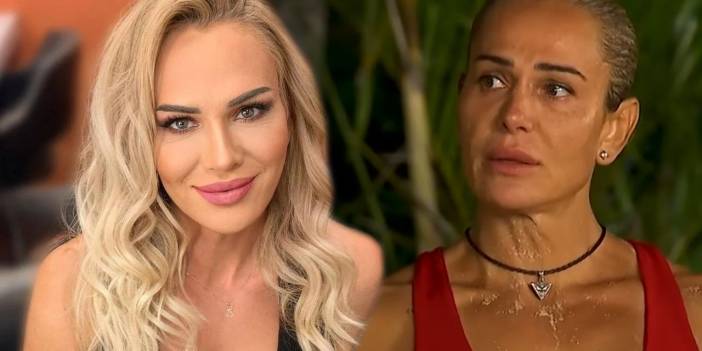 Survivor Nagihan Karadere'den estetik itirafı : Gerdirdim