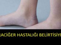 Karaciğer ihlame gelmez : Bitmekte olduğunun 4 belirtisi