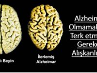 Alzheimer Hastası Olmamak için bu alışkanlıkları terk etmelisiniz