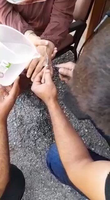 Elazığ’da Parmağa Sıkışan Yüzüğü İtfaiye Ekipleri Çıkardı