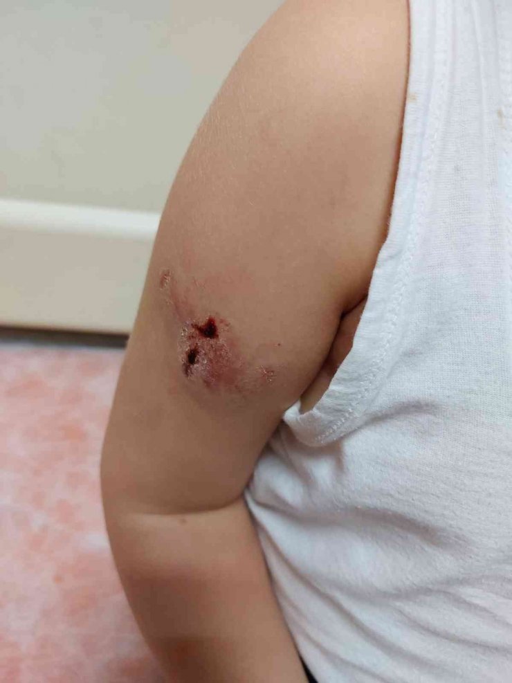 Zonguldak’ta Sahipsiz Köpekler 5 Yaşındaki Çocuğa Saldırdı