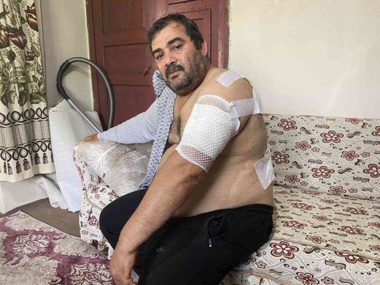 Ayı Saldırısına Uğrayan Vatandaş: “beni Öldü Zannetti”